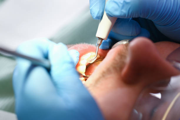 Best Emergency Dentist for Lost Fillings or Crowns in Dennis Port, MA